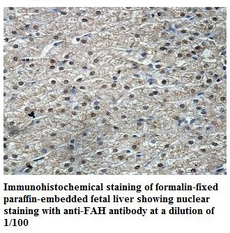 Anti-FAH Antibody