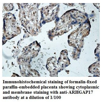 Anti-ARHGAP17 Antibody