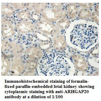 Anti-ARHGAP20 Antibody