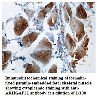 Anti-ARHGAP21 Antibody