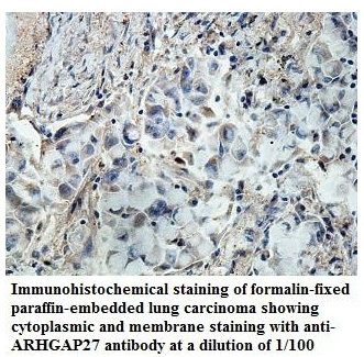 Anti-ARHGAP27 Antibody