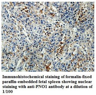 Anti-PNO1 Antibody