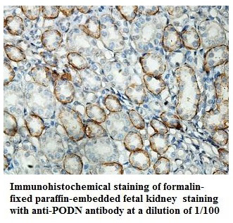 Anti-PODN Antibody