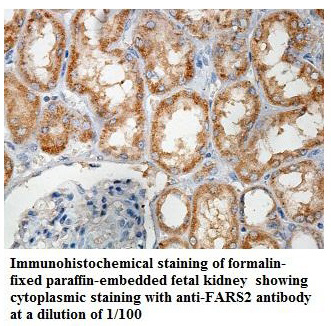 Anti-FARS2 Antibody