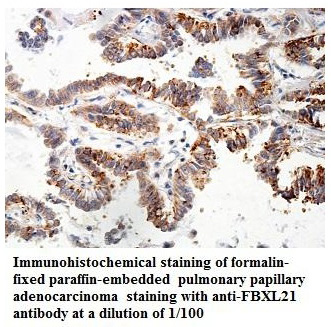 Anti-FBXL21 Antibody