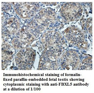 Anti-FBXL5 Antibody