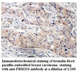 Anti-FBXO10 Antibody