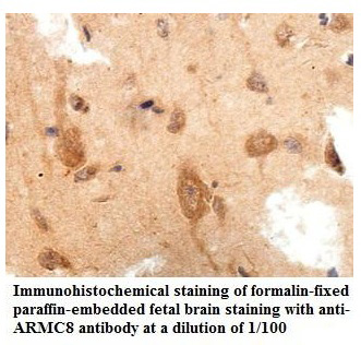 Anti-ARMC8 Antibody