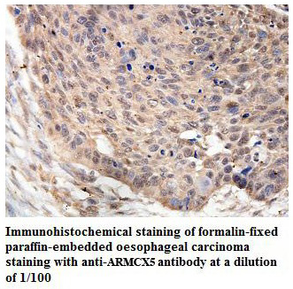Anti-ARMCX5 Antibody