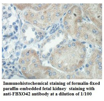 Anti-FBXO42 Antibody