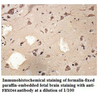Anti-FBXO44 Antibody