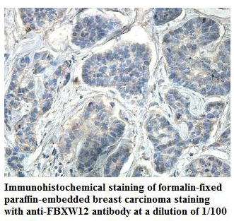 Anti-FBXW12 Antibody
