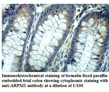 Anti-ARPM1 Antibody