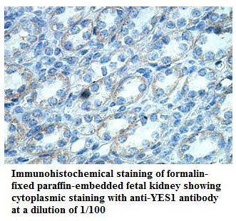 Anti-YES1 Antibody