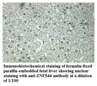 Anti-ZNF544 Antibody
