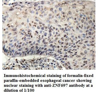 Anti-ZNF697 Antibody