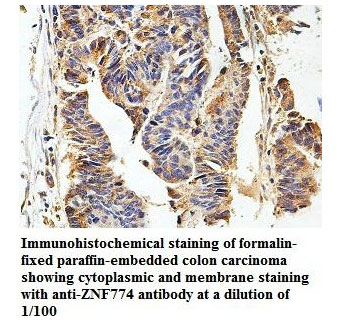 Anti-ZNF774 Antibody
