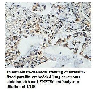 Anti-ZNF786 Antibody