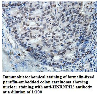 Anti-HNRNPH2 Antibody