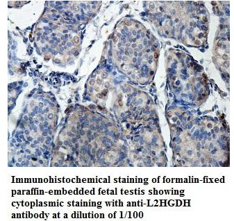 Anti-L2HGDH Antibody