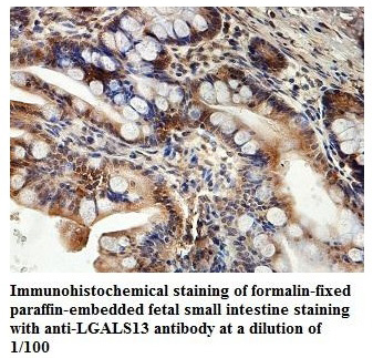 Anti-LGALS13 Antibody