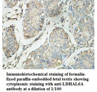 Anti-LDHAL6A Antibody
