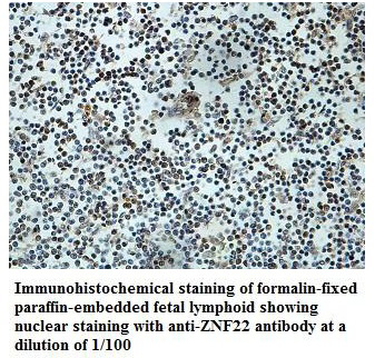 Anti-ZNF22 Antibody