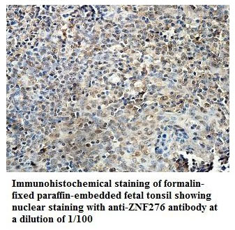 Anti-ZNF276 Antibody