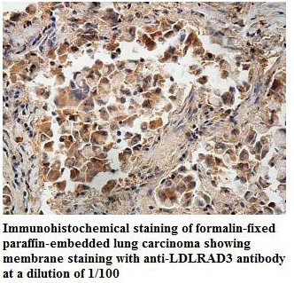 Anti-LDLRAD3 Antibody