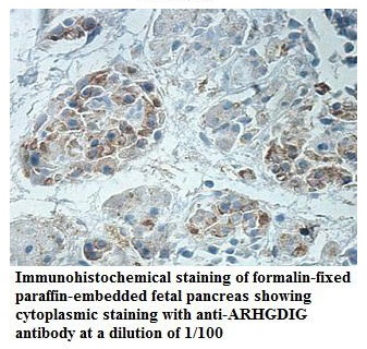 Anti-ARHGDIG Antibody