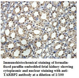 Anti-TARBP2 Antibody