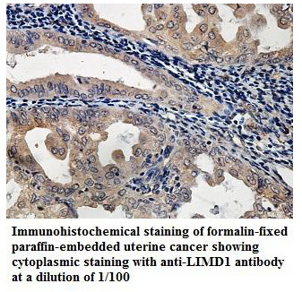Anti-LIMD1 Antibody