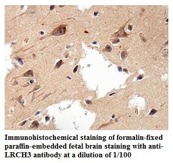 Anti-LRCH3 Antibody
