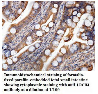 Anti-LRCH4 Antibody