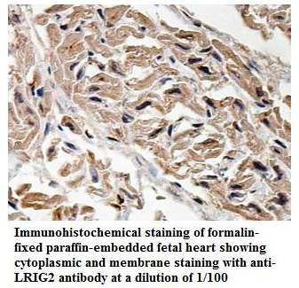 Anti-LRIG2 Antibody