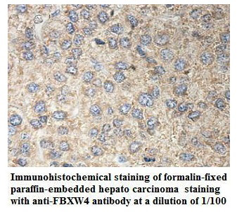 Anti-FBXW4 Antibody