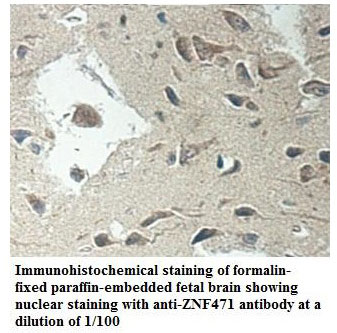 Anti-ZNF471 Antibody