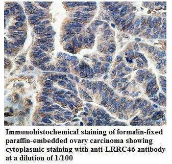 Anti-LRRC46 Antibody