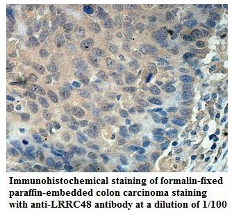 Anti-LRRC48 Antibody