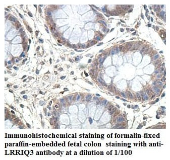Anti-LRRIQ3 Antibody
