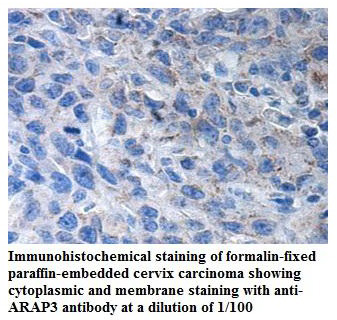 Anti-ARAP3 Antibody