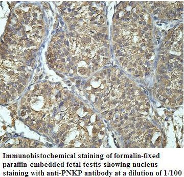 Anti-PNKP Antibody