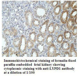 Anti-LYPD1 Antibody