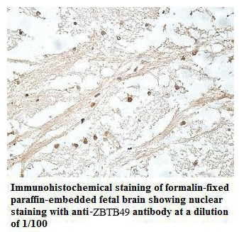 Anti-ZBTB49 Antibody