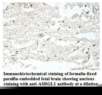 Anti-ASRGL1 Antibody