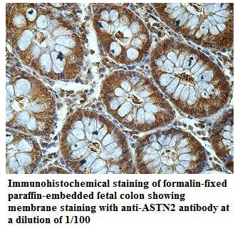 Anti-ASTN2 Antibody