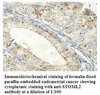 Anti-STOML2 Antibody