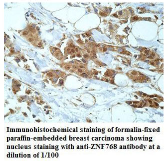 Anti-ZNF768 Antibody