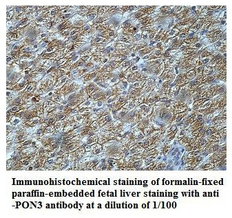 Anti-PON3 Antibody