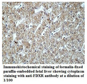 Anti-FDXR Antibody
